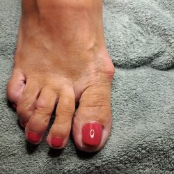 eelt verwijderen pedicurebehandeling na ursem noord holland nagels lakken